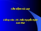 Đề tài " Căn bệnh Hà Lan "