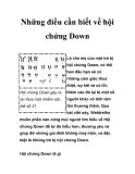 Những điều cần biết về hội chứng Down