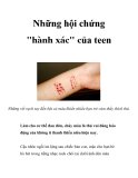 Những hội chứng "hành xác" của teen