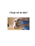 Chuột rút do đâu?  