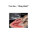 Van tim... “đỏng đảnh” 