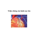 Triệu chứng của bệnh suy tim  