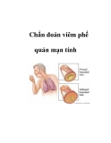 Chẩn đoán viêm phế quản mạn tính   