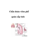 Chẩn đoán viêm phế quản cấp tính  