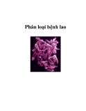 Phân loại bệnh lao  