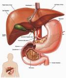 Viêm gan tự miễn (AIH) - Dịch theo Autoimmune Hepatitis