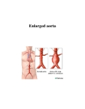 Enlarged aorta 