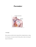 Pacemaker 