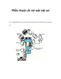 Phẫu thuật cắt túi mật nội soi 