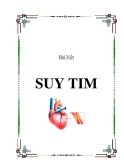 CHẨN ĐOÁN BỆNH SUY TIM