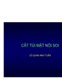 PHẪU THUẬT CẮT TÚI MẬT QUA NỘI SOI