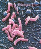 Tài liệu: Viêm dạ dày do Helicobacter Pylori