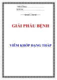 NGUYÊN NHÂN VIÊM KHỚP DẠNG THẤP