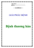 Điều trị Bệnh thương hàn