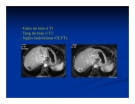 Chẩn doán hình ảnh : Gan - Mật part 4