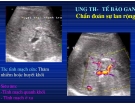 Chẩn doán hình ảnh : U Gan part 7