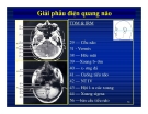 Giải phẫu thần kinh đối chiếu chẩn đoán Hình ảnh part 8