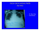 Tràn dịch màng phổi part 5