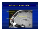 Bệnh viêm nhiễm ở não part 4