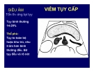 Viêm tụy cấp và mãn tính part 3