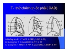 Thực hành x quang tim mạch part 2