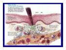 Bài giảng bệnh lý học thú y : Viêm - inflammatio part 6