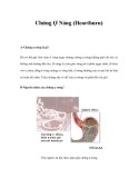 Chứng Ợ Nóng (Heartburn) 