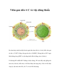 Viêm gan siêu vi C - dùng thuốc điều trị 