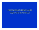 XQ GAN MẬT