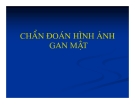 Chuẩn đoán hình ảnh gan mật