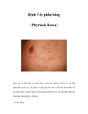 Bệnh Vẩy phấn hồng (Pityriasis Rosea) 