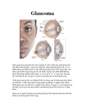 Glaucoma 