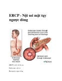 ERCP - Nội soi mật tụy ngược dòng 