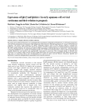 Báo cáo toán học: "Expressions of EphA2 and EphrinA-1 in early squamous cell cervical carcinomas and their relation to prognosis"