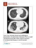 báo cáo khoa học: "Case of an unusual clinical and radiological presentation of pulmonary metastasis from a costal chondrosarcoma after wide surgical resection: A transbronchial biopsy is recommended"