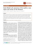 báo cáo khoa học: "Giant Merkel cell carcinoma of the eyelid: a case report and review of the literature"