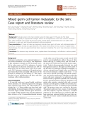 Báo cáo khoa học: "Mixed germ cell tumor metastatic to the skin: Case report and literature review"