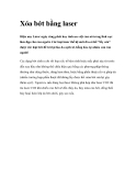 Xóa bớt bằng laser