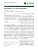 Báo cáo y học: "Vasculogenesis in rheumatoid arthritis"
