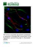 The tumour-associated glycoprotein podoplanin is expressed in fibroblast-like synoviocytes of the