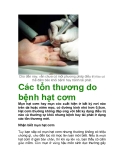 Các tổn thương do bệnh hạt cơm