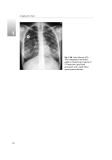 Radiology for Anaesthesia and Intensive Care - Part 3