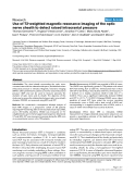 Báo cáo y học: "Use of T2-weighted magnetic resonance imaging of the optic nerve sheath to detect raised intracranial pressure"