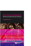 Basic Electrocardiography Normal and abnormal ECG patterns - Part 1