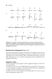 Basic Electrocardiography Normal and abnormal ECG patterns - Part 4