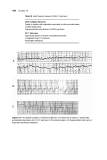 Basic Electrocardiography Normal and abnormal ECG patterns - Part 8