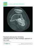 Báo cáo y học: "Parosteal osteosarcoma mimicking osteochondroma: A radio-histologic approach on two cases"