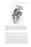 Heart Disease in Pregnancy - part 6