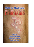 Mild-to-Moderate  Psoriasis - part 1 