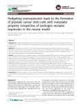 Báo cáo y học: "Hedgehog overexpression leads to the formation of prostate cancer stem cells with metastatic property irrespective of androgen receptor expression in the mouse model"